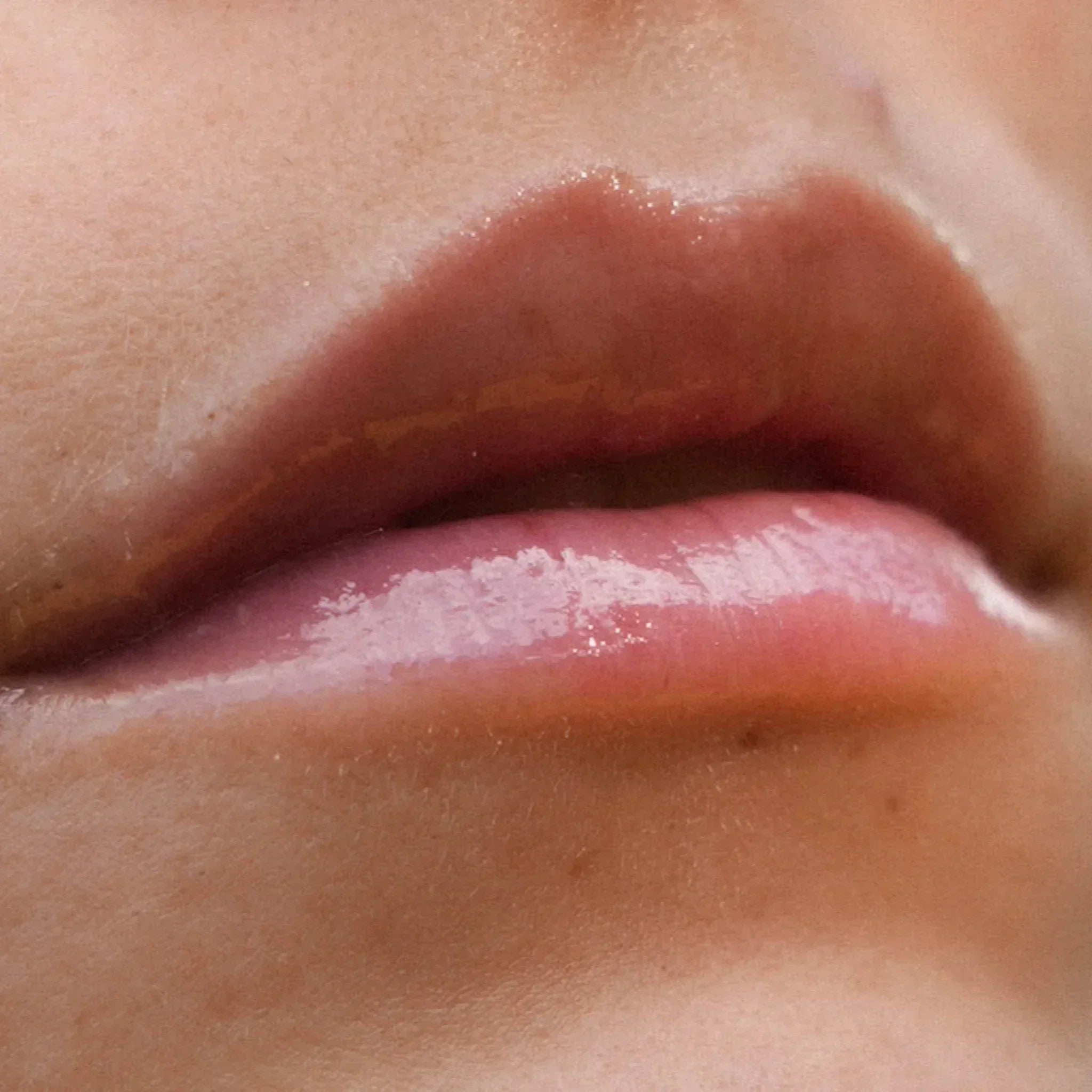 TRATAMIENTO DE LABIOS